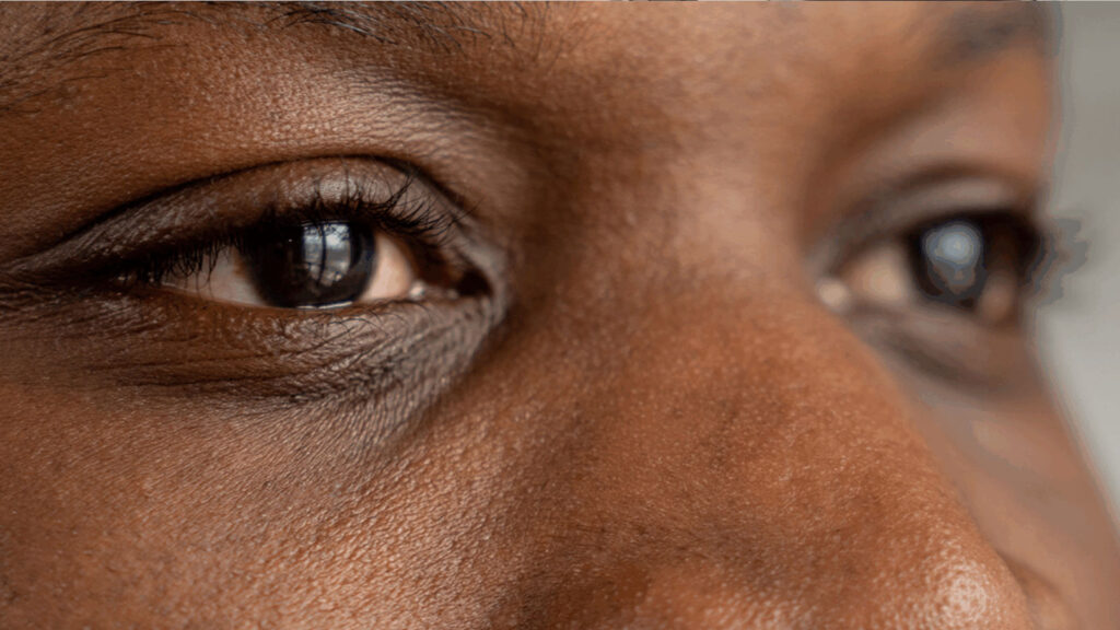 Close-up of a person's eyes and skin, depicting detail and texture in natural lighting.