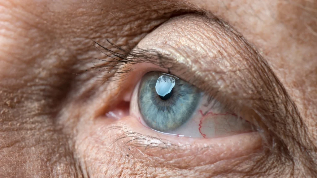 Close-up of a blue eye with detailed skin texture and eyelashes, highlighting human aging and eye features.