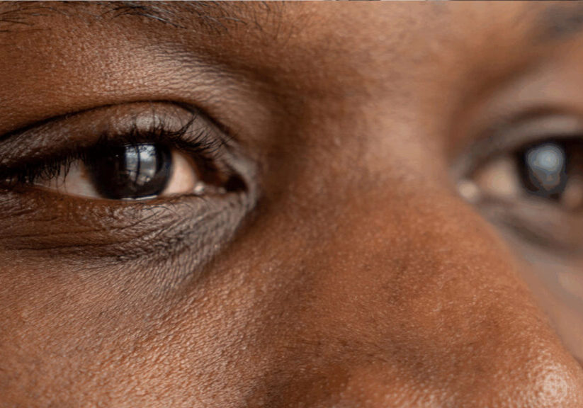 Close-up of a person's eyes and skin, depicting detail and texture in natural lighting.