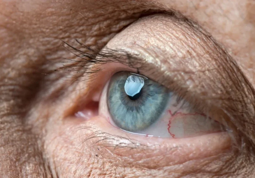 Close-up of a blue eye with detailed skin texture and eyelashes, highlighting human aging and eye features.