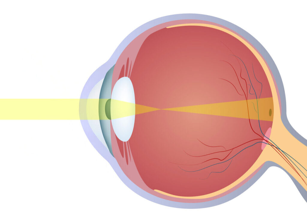 Illustration of a human eye cross-section showing light focusing on the retina for vision.
